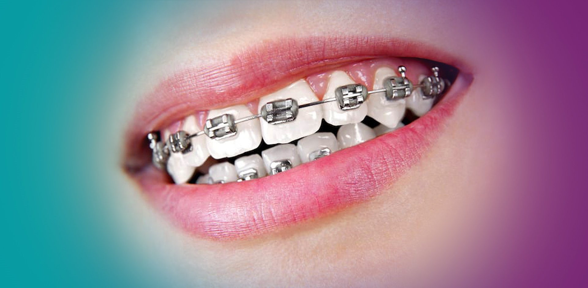 Orthodontics