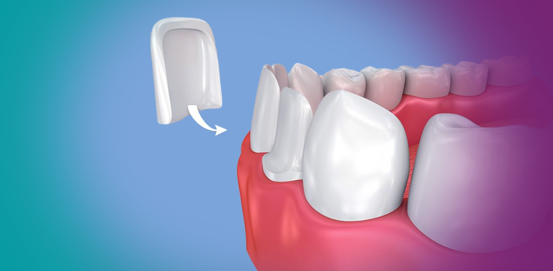 Prosthodontics